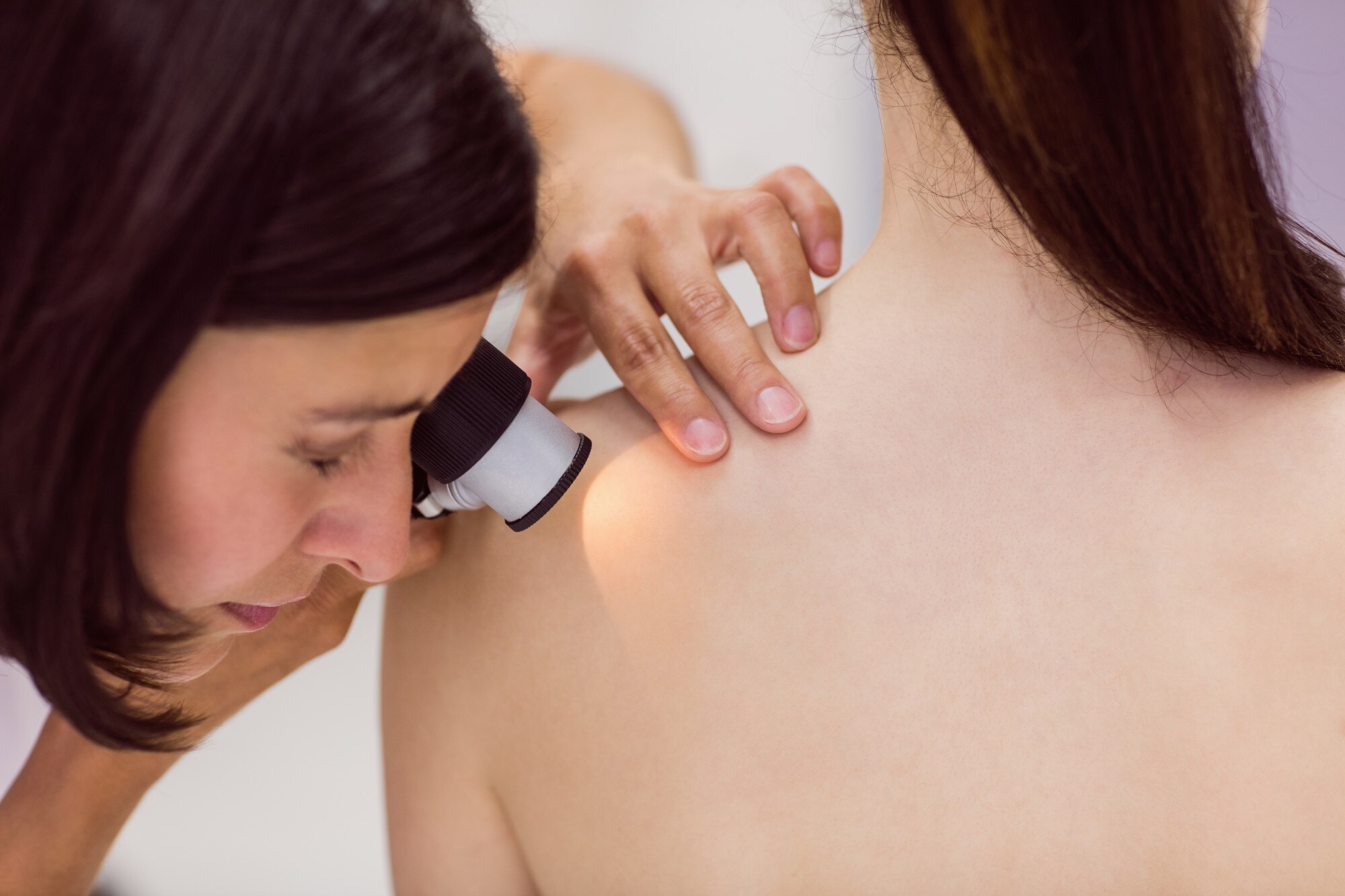 dermatologist examining skin patient with dermatoscope 107420 65621